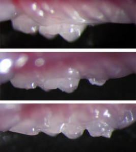 dents dents