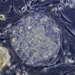 La reprogrammation cellulaire : un nouvel outil contre le diabète